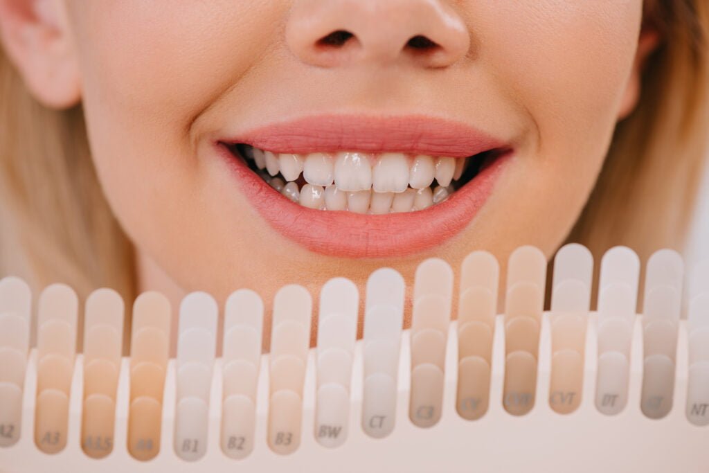 Teeth Whitening In Kuala Lumpur Whitening KL Archident Dental Clinic