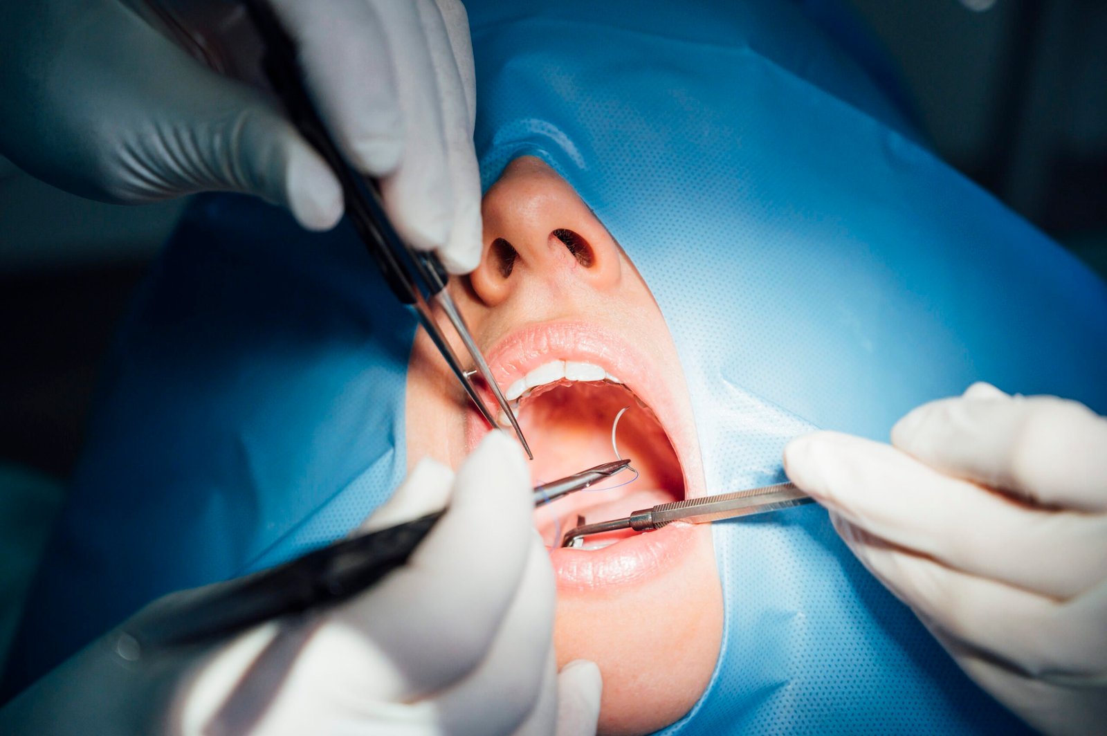 Minor Oral Surgery in Kuala Lumpur