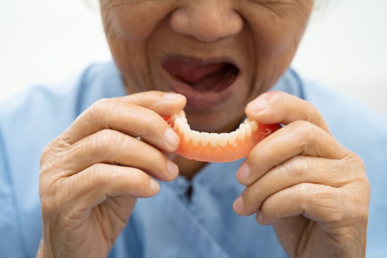 Finding the Right Denture Solution Full vs Partial Dentures KL